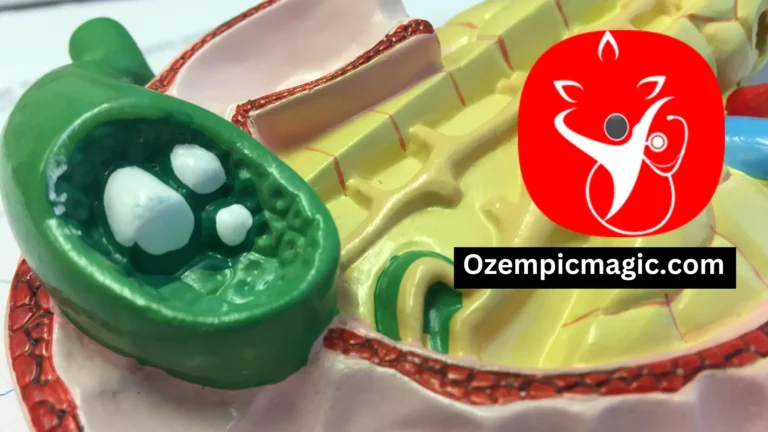 Can I Take Ozempic After Gallbladder Removal